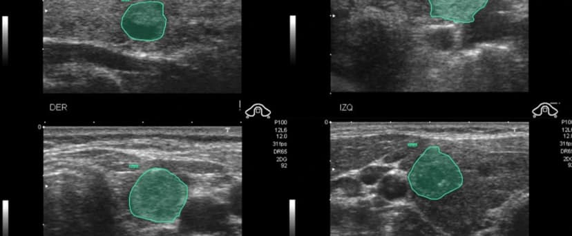 Solving cross-border talent gap for medical annotation across SEA